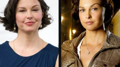 Ashley Judd Plastic Surgery