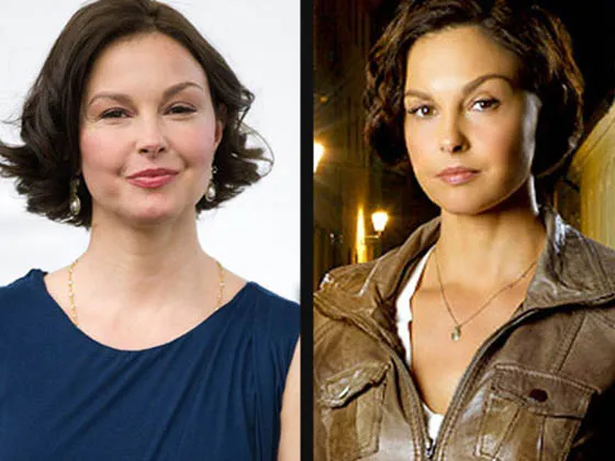 Ashley Judd Plastic Surgery